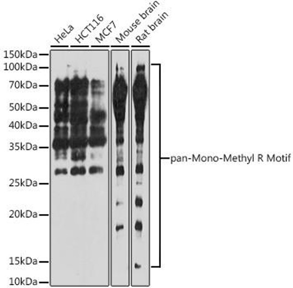 pan-Mono-Methyl Arginine Motif Rabbit Polyclonal Antibody (CAB17984)