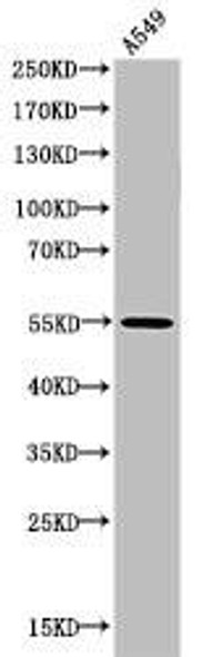 Acetyl-RELA (K218) Antibody (PACO06064)