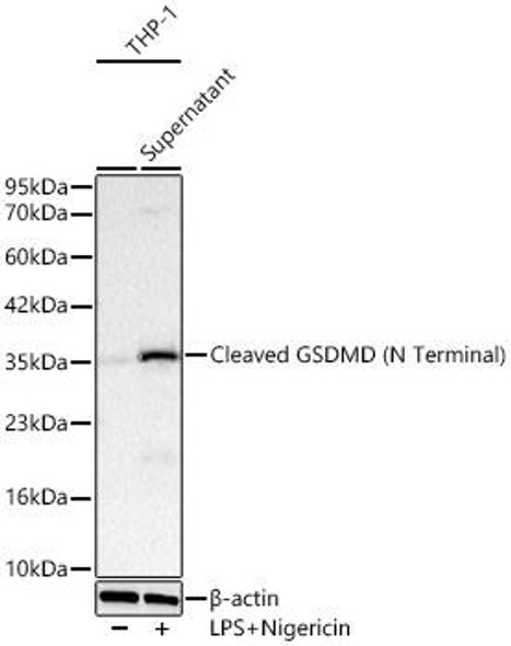 Cleaved Gasdermin D (N Terminal) Rabbit Monoclonal Antibody (CAB24059)