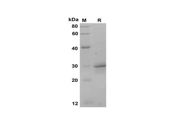 Recombinant Monkey CT Protein(Gst Tag) (RPES8001)