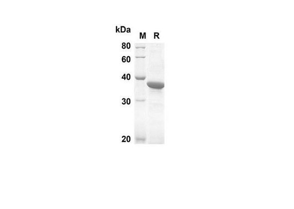 Recombinant Human MLKL Protein(Sumo Tag) (RPES8019)