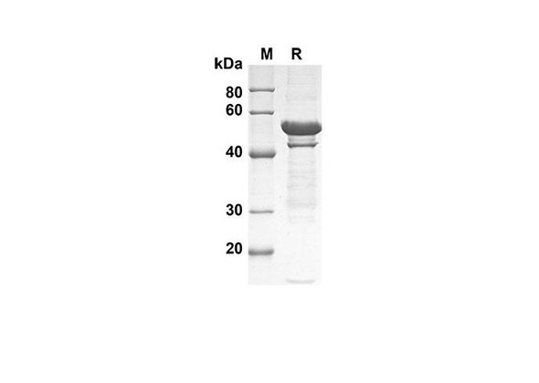 Recombinant Human ITGAX Protein(Trx Tag) (RPES8079)