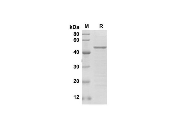Recombinant Human SNAI1 Protein(Sumo Tag) (RPES8117)
