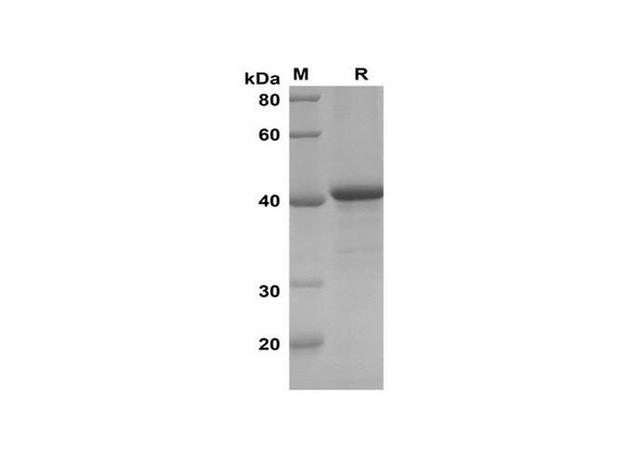 Recombinant Human FN1 FN Protein(Trx Tag) (RPES8123)