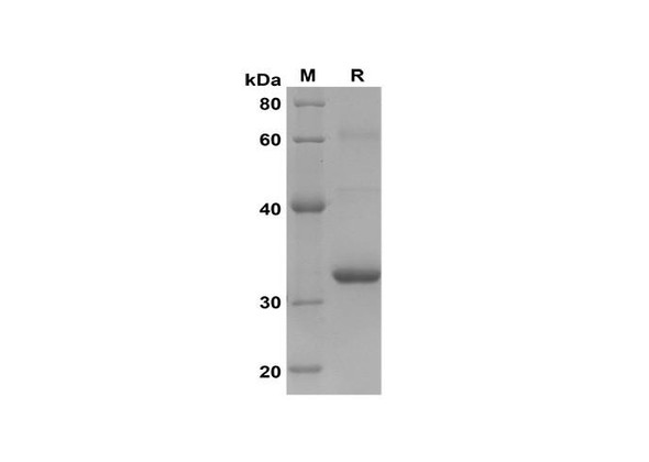 Recombinant Human VWF F8VWF Protein(Trx Tag) (RPES8124)