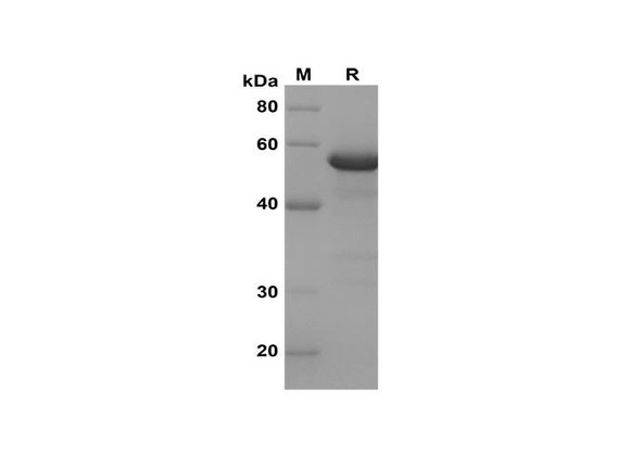 Recombinant Human HK2 Protein(Trx Tag) (RPES8133)