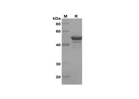 Recombinant Human TH TYH Protein(Sumo Tag) (RPES8141)