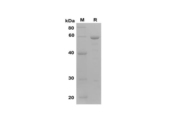 Recombinant Mouse ARG1 Protein(Gst Tag) (RPES8177)