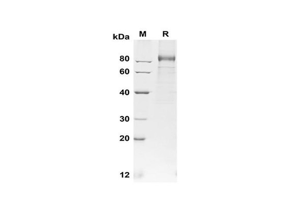 Recombinant Human G-CSF R/CD114 Protein (His Tag) (RPES8374)