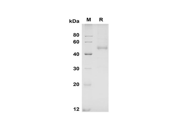 Recombinant Mouse NOV/CCN3 Protein (His Tag) (RPES8496)