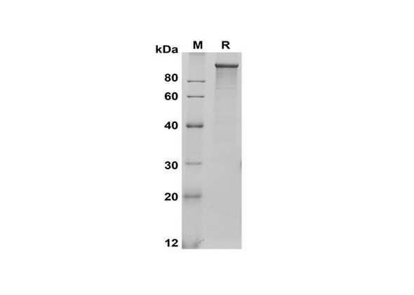 Recombinant Rat LDLR Protein (His Tag) (RPES8542)