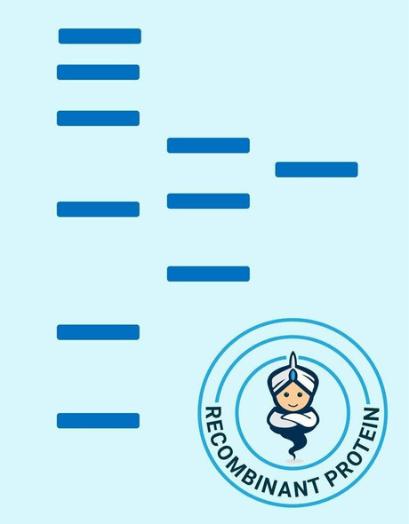 Human ACM4-Strep full length protein-synthetic nanodisc (HDFP909)