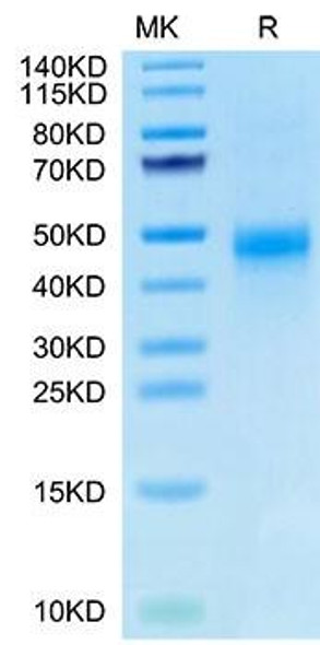 Biotinylated Recombinant Human CTGF/CCN2 Protein (RPCB0072)