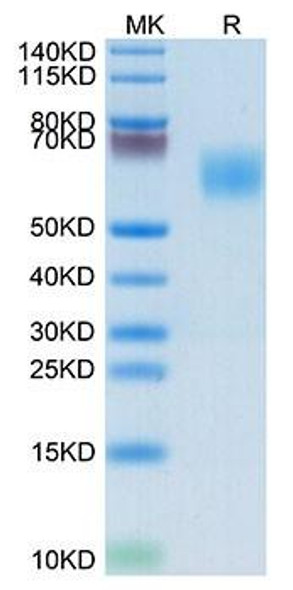 Biotinylated Recombinant Human MHC class I polypeptide-related sequence A/MIC-A Protein (RPCB0103)