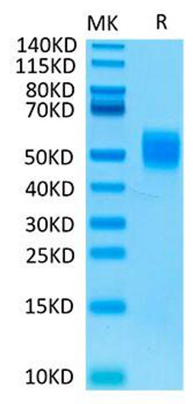 Biotinylated Recombinant Human MHC class I polypeptide-related sequence B/MIC-B Protein (RPCB0105)