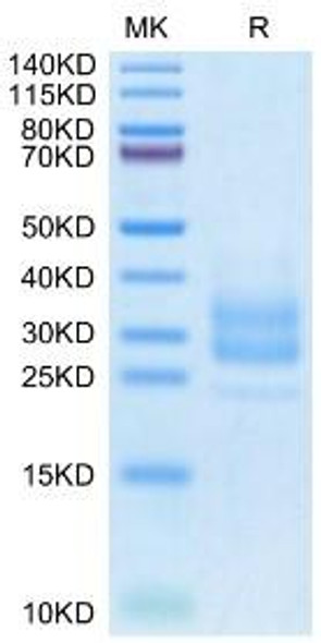 Recombinant Monkeypox virus M1R Protein (RPCB0125)