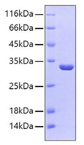 Recombinant Human Sulfotransferase 1A1/SULT1A1 Protein (RPCB0141)