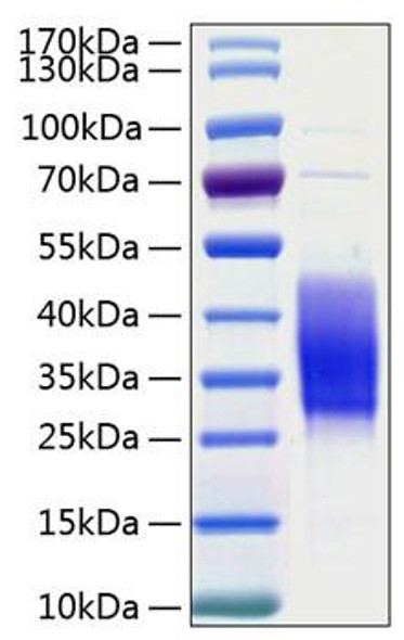 Recombinant Human TIM-3/HAVCR2/CD366 Protein (RPCB0167)