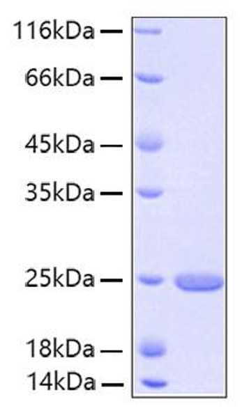 Recombinant Human FGF-21 Protein (RPCB0171)