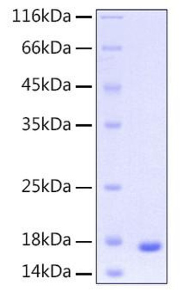 Recombinant Human UBE2D3 Protein (RPCB0178)