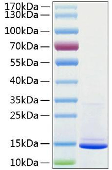 Recombinant Human Beta-2-microglobulin/B2M Protein (RPCB0192)