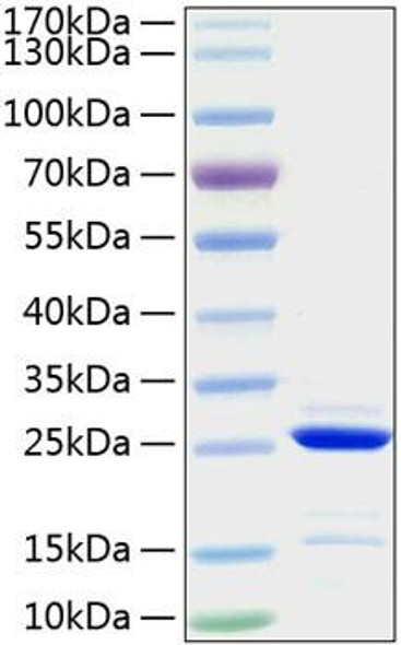 Recombinant Human Bcl-2 Protein (RPCB0204)
