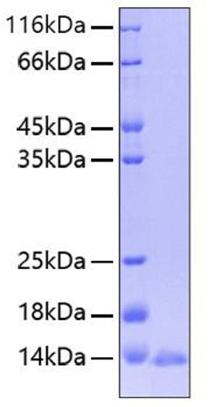 Recombinant Human Leptin/LEP Protein (RPCB0242)