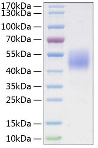 Recombinant Human B7-H4/VTCN1 Protein (RPCB0272)