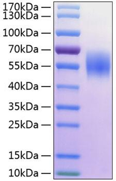 Recombinant Human MHC class I polypeptide-related sequence A/MIC-A Protein (RPCB0286)