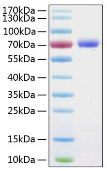 Recombinant Human B7-H1/PD-L1/CD274 Protein (RPCB0304)