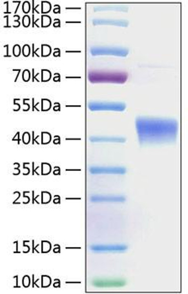 Recombinant Human IL-22RA2/IL22BP Protein (RPCB0308)
