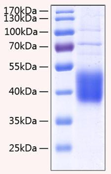 Recombinant Human IL-21R/CD360 Protein (RPCB0322)