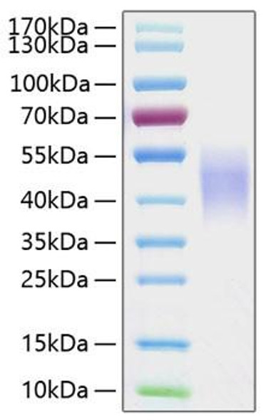 Recombinant Human Fc-gamma RIII beta/FCGR3B/CD16b Protein (RPCB0345)