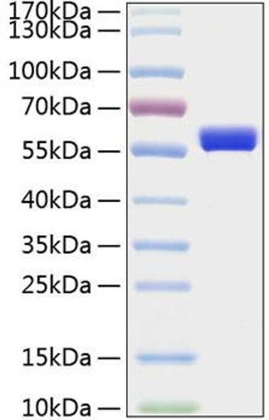 Recombinant Human MMP-1 Protein (RPCB0417) Recombinant Human MMP-1 Protein (RPCB0417)