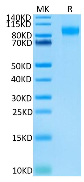 Biotinylated Recombinant Human E-Selectin/SELE/CD62E Protein (RPCB0446)