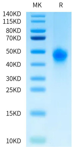 Biotinylated Recombinant Human Fc-gamma RIII beta/FCGR3B/CD16b (S36R, N82D, I106V) Protein (RPCB0487)