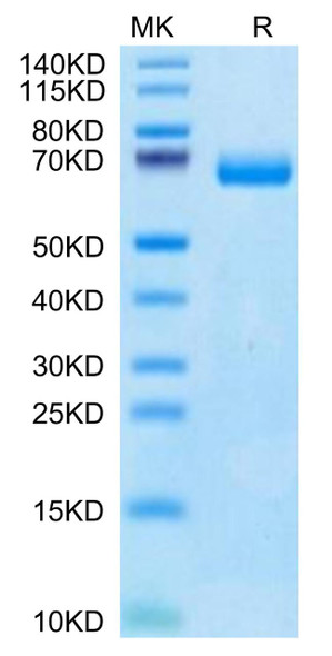 Recombinant Human IL-2 R beta/CD122 Protein (RPCB0506)