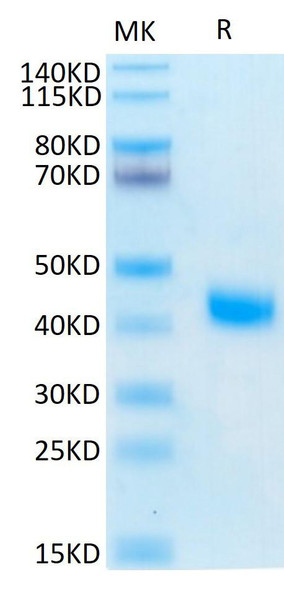 Recombinant Human IL-2 R beta/CD122 Protein (RPCB0539)