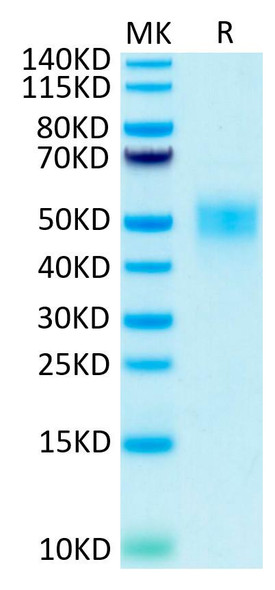 Biotinylated Recombinant Human Fc-gamma RIII beta/FCGR3B/CD16b Protein (RPCB0563)