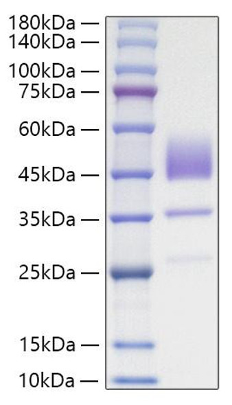 Recombinant Human Brain Natriuretic Peptide/NT-proBNP Protein (RPCB0709)