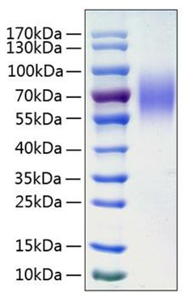 Recombinant Human LAMP-1/CD107a Protein (RPCB0783)