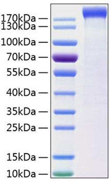 Recombinant Human Leptin receptor/LEP-R/CD295 Protein (RPCB0839)