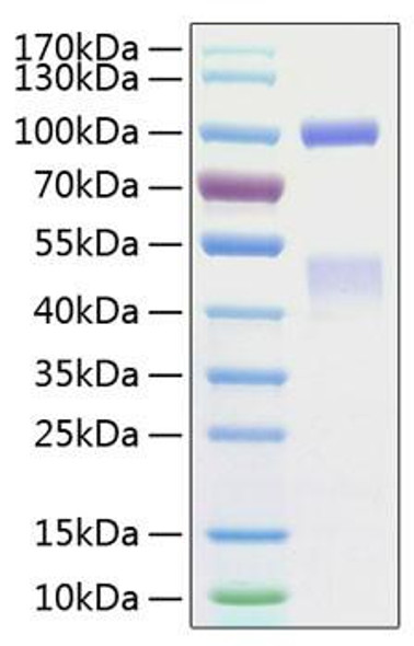 Recombinant Human HGF receptor/c-MET/MET Protein (RPCB0852)
