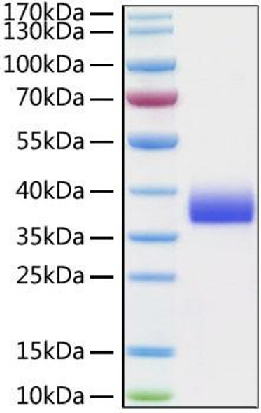Recombinant Cynomolgus Siglec-15/CD33L3 Protein (RPCB0860)