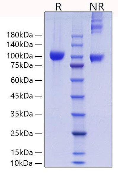 Recombinant Mouse MMP-9 Protein (RPCB0861)
