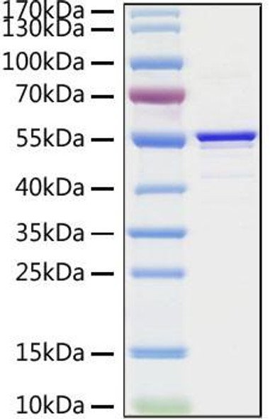 Recombinant SARS-CoV Nucleocapsid Protein (RPCB0867)