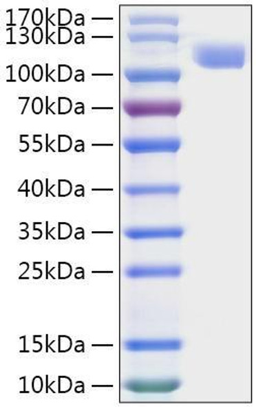 Recombinant MERS-CoV Spike S1 Protein (RPCB0869)