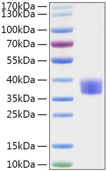 Recombinant MERS-CoV Spike RBD  Protein (RPCB0882)
