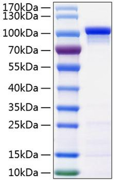 Recombinant Human Catenin beta-1/CTNNB1 Protein (RPCB0907)
