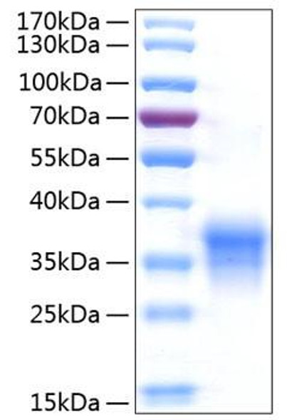 Recombinant Human IFN-lambda 1/IL-29 Protein (RPCB0934)